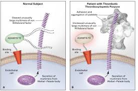 Image result for Plasmic Score