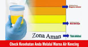 Warna air seni orang sehat. Check Kesehatan Anda Melalui Warna Air Kencing Zeropromosi Souvenir Barang Promosi Grosir Souvenir Kantor