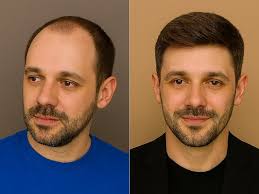 TOP 10 BEST Root Touch Up near Woodland Hills, Los Angeles, CA