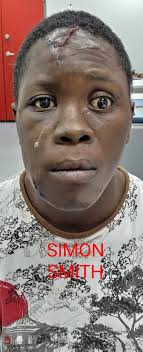 January 11th, 2023 MEDIA RELEASE Robbery Suspect Escapes Death After Car  Crash- But Could Not Escape the Police A 21-year-old man of O'meara Road,  Arima, is due to appear at the Arima