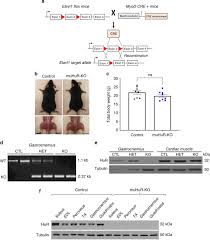 Ce denier s'exprimait suite au décès, lundi 26 juillet à 23 h, de maxime beltra, un jeune sétois de 22 ans, décédé des suites œdème de quincke. Depletion Of Hur In Murine Skeletal Muscle Enhances Exercise Endurance And Prevents Cancer Induced Muscle Atrophy Nature Communications