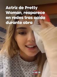 🌟 Eva Gary, actriz de Pretty Woman, reapareció en redes tras caer dos  metros desde el escenario, a pesar de tener fracturas en ambas muñecas, una  en la nariz sin complicaciones y una conmoción, dice ...
