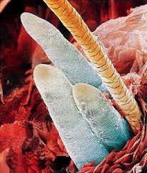 Image result for Demodex brevis