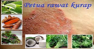 Panu merupakan penyakit kulit yang disebabkan oleh jamur malassezia. Petua Macam Mana Nak Menghilangkan Kurap Secara Semulajadi Dengan Berkesan Semua Semua Semuanya