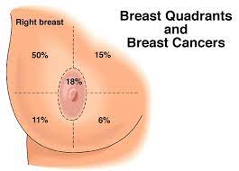 It can also occur in the armpit area, where there is more breast tissue (a.k.a. Breast Cancer Naija247medic S Blog