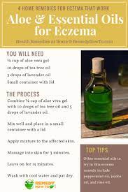 4 Home Remedies For Eczema That Work Eczema Remedies Essential Oils For Eczema Home Remedies For Eczema