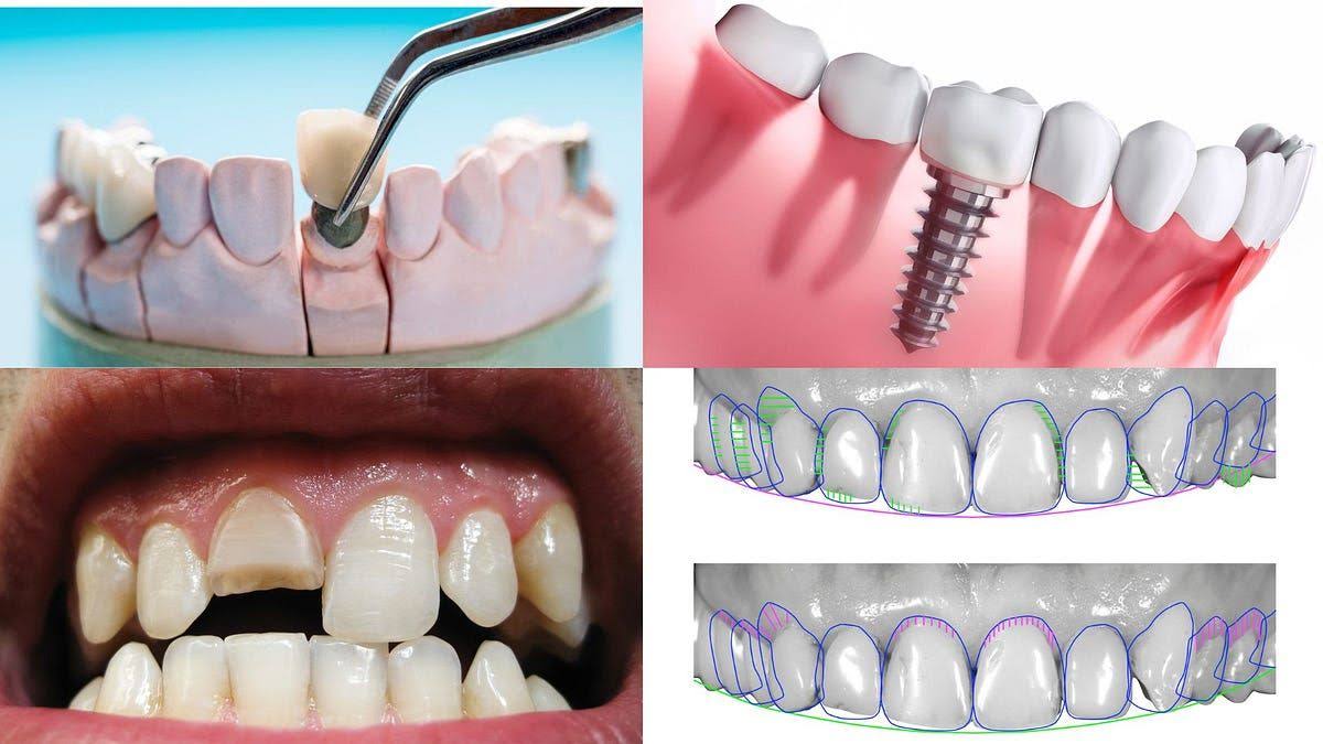 Dentist in Sus, Pune | Trusted Dental Clinic In Sus product image