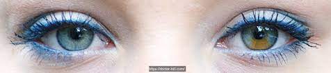 What Is Heterochromia Not Two Irises Are Alike Including The Irises Of Identical Twins And Even The Two Iri Heterochromia Heterochromia Iridum Beautiful Eyes