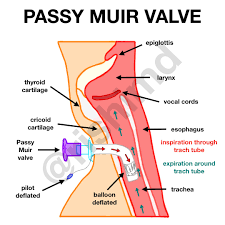 Passy Muir Valve | RK.MD