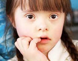 Mom I Hate Having Down Syndrome Friendship Circle Special Needs Blog Friendship Circle Special Needs Blog