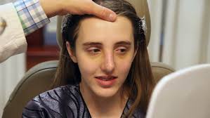 Tormented over their looks? Bullied teens seek free plastic surgery from a  NYC nonprofit