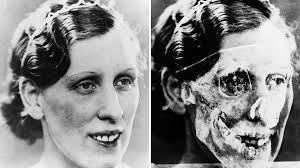 The murder victim denied justice