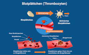 Thrombozyten werden im allgemeinen als bezeichnet plättchen. Thrombozyten Blutplattchen Bedeutung Praktischarzt
