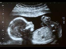 But there is one fairly simple rule when it comes to pronoun usage: When Can I Find Out My Baby S Gender Youtube
