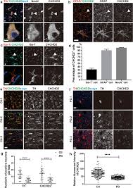 Последние твиты от instagram (@instagram). Reduced Erythrocytic Chchd2 Mrna Is Associated With Brain Pathology Of Parkinson S Disease Springerlink