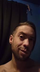 FIF! A few more days until I get these crazy staples outta my noggin! And,  followup meeting with my neurology team to decide