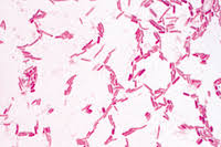 The staining procedure differentiates organisms of the domain bacteria according to cell wall structure. Salmonella Paratyphi Paratyphoid Fever Smear Instruments Direct