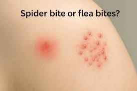 Image result for flea bite