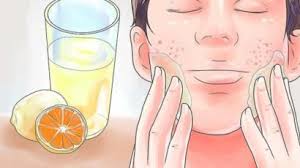 Okkey uolls,korang ade parut kat muke or badan korg tak??kalau ada boleh larr try petua nihh. Parut Jerawat Menganggu Anda Ini 6 Cara Untuk Menghilangkannya Nurraysa