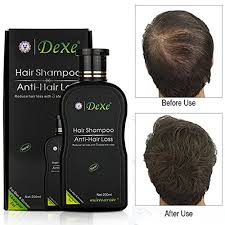 Female hair loss can include: Buy Dexe Unisex Hair Shampoo Set Anti Hair Loss Chinese Herbal Hair Growth Product Prevent Hair Treatment 200ml Kp011900 Online At Low Prices In India Amazon In