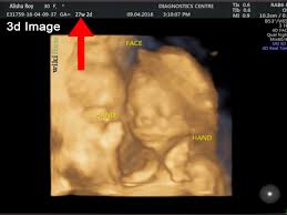 Jika bayi anda perempuan, ovarium mulai menghasilkan jutaan sel telur pada minggu ini. Cara Membaca Foto Usg 8 Langkah Dengan Gambar Wikihow