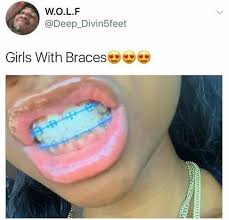 Bracefaces In 2020 Braces Colors Cute Braces Braces Teeth Colors