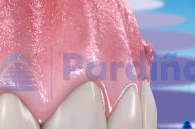 Image result for phlegmon on face)