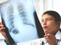 Schedule using labfinder and access your results anytime. Copd X Ray Pictures Diagnosis And More