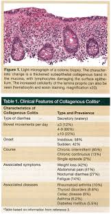 Image result for Microscopic Colitis