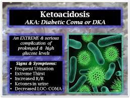 Pin By Karen Layus On Diabetes Type Ii Nursing Tips Icu Nursing Nursing Fun