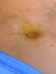 Maybe this was the end result after a. The Belly Button Lint In The Body Shot Marriedatfirstsight