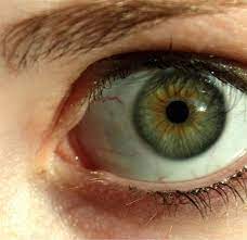 Why Do Some People Have Dark Rings Around The Iris Of Their Eye Rare Eye Colors Dark Rings Around Eyes Rare Eyes