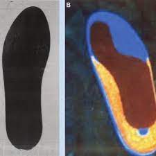 Morton's neuroma is a benign, noncancerous growth of nerve tissue in the foot, usually between the third and fourth toes. Orthotic Options For Turf Toe Injury A Carbon Fiber Turf Toe Plate Download Scientific Diagram