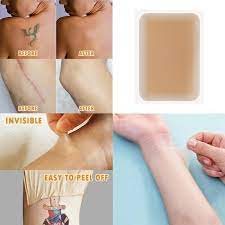 Tattoo Cover Up Sticker Breathable Tattoo Flaw Concealing Tape For Scar Birthmark Cover Up Sticker Flesh Colored Waterproof Skin Friendly Wish In 2021 Cover Tattoo Waterproof Tattoo Cover Up Scar Cover Up
