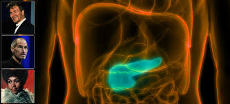 Pancreatic cancer is seldom detected at its early stages when it's most curable. Stage 3 Pancreatic Cancer Life Expectancy Cancer Horizons