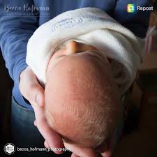 Yaasss The Top Of Babies Head The Fontanelle That Soft Spot That Does Amazing Things For Babies One It Is The First New Baby Products Baby Crown Baby Head