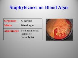Beta hemolysis, blood agar, staphylococcus aureus. Pht 313 Lab 1 Staphylococci Bacteria Grams Stain