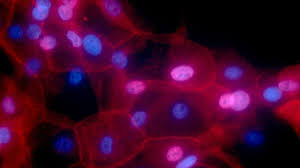 Invasive breast cancer is more common in women over age 55. Fda Include Male Breast Cancer Patients In Trials