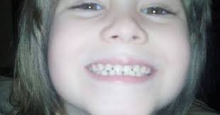 Neglect cited as cause of Miller death