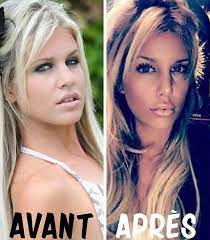 Check spelling or type a new query. Avant Apres Adixia Romaniello Les Ch Tis Facebook