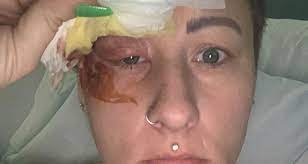 I Was Almost Blinded By A Hair In My Eye Real Fix Magazine
