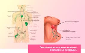 Limfouzly Na Shee Prichiny I Simptomy Vospaleniya Kak Lechit Vospalyonnye Limfouzly