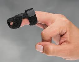 With mallet finger, the tendon on the back of the finger (not the palm side) is separated from the muscles it connects. Auerbach Mallet Splint North Coast Medical