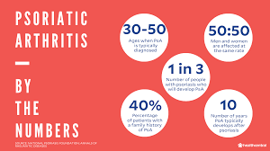 What are the 5 types of psoriatic arthritis. Psoriatic Arthritis Signs Symptoms Causes Diagnosis And Treatments
