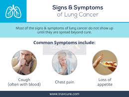 Because lung cancer develops in the lungs, as you'd probably expect, its most common symptoms involve the lungs. Medical Tourisum India Travcure