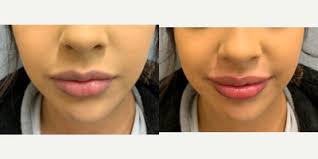 Aimee Nguyen, MD, Board Certified OB-GYN