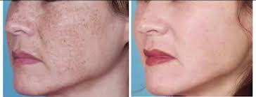 REDjuvenator Reviews RED LIGHT THERAPY Quantum Healing SCIENCE