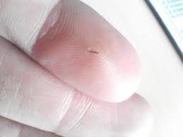 How To Make A Poultice For Removal Of Splinters Boils And Abscesses Splinter Removal Cleaning Hacks Deep Cleaning Tips