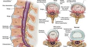 09053 03x Jpg 550 425 Anatomy And Physiology Stenosis Physiology