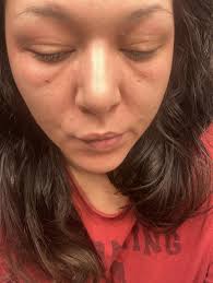 Therapeutic Indulgence In South Bend IN